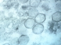 Afrikansk svinpest-virus