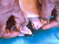 Ulcera tandplatta