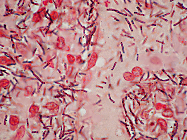 Histologiskt snitt med mjältbrandsbakterier