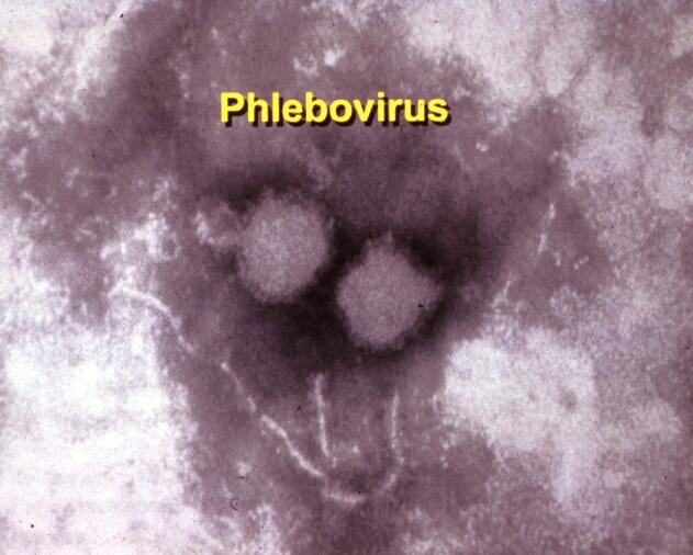 elektronmikroskopisk bild av phlebovirus