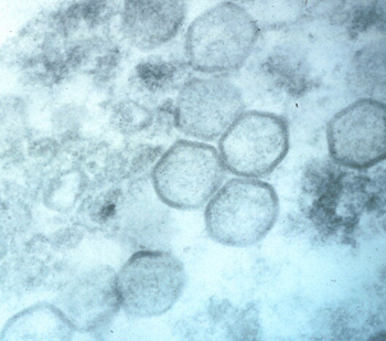 Elektronmikroskopisk bild av afrikansk svinpestvirus
